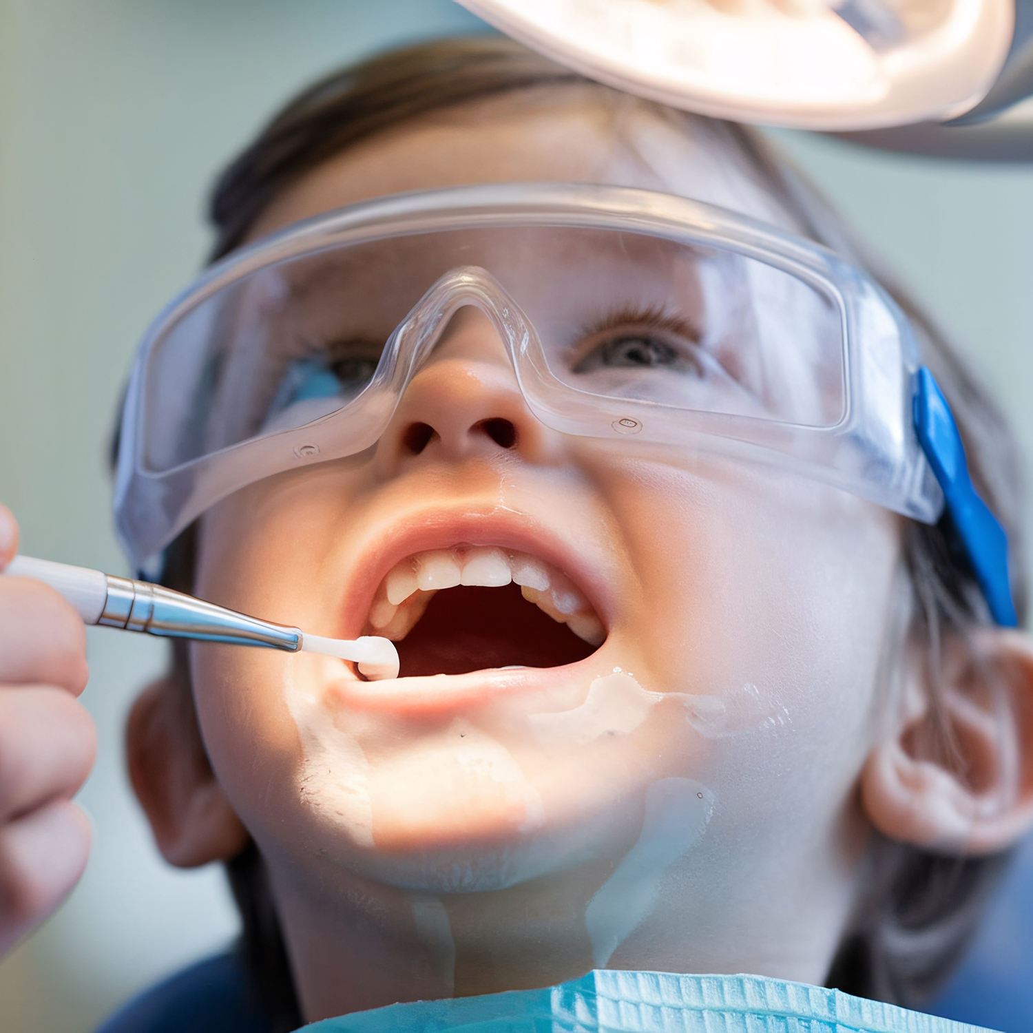 FLUORIZARE